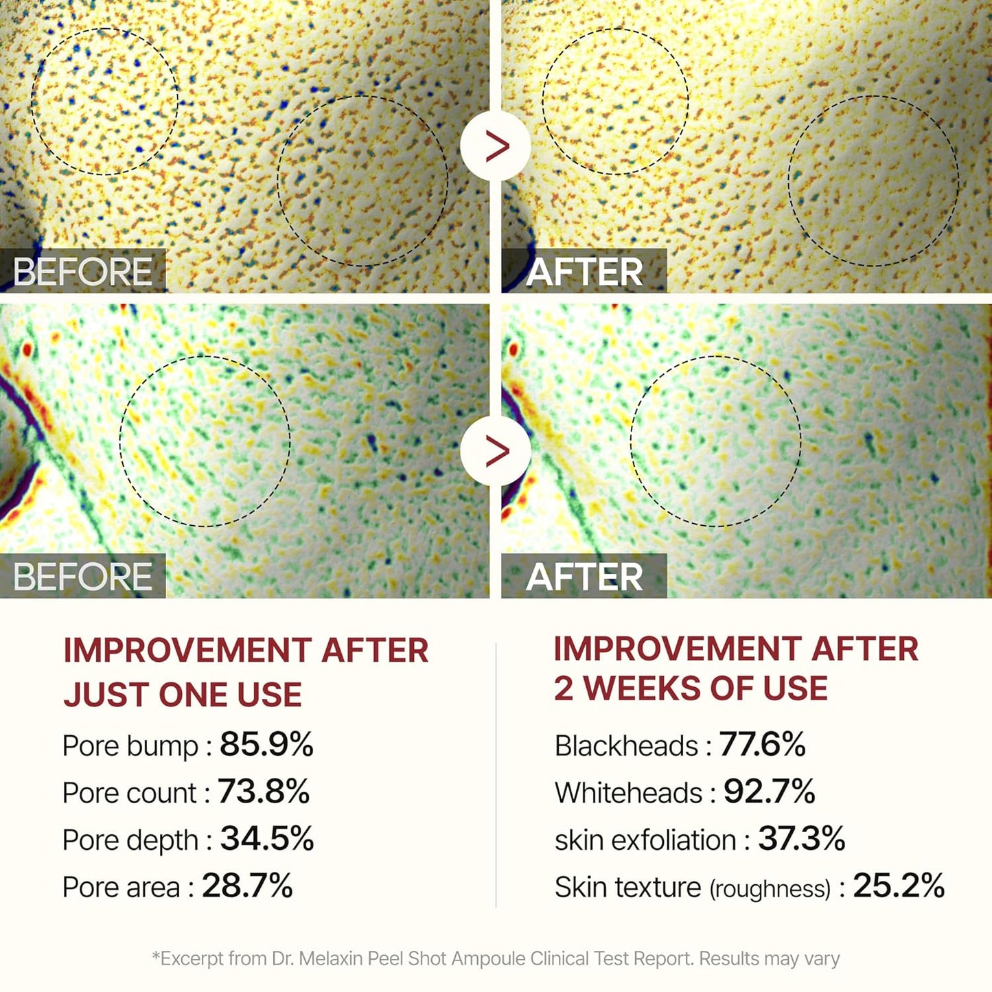 Hydrating GlowRice™ Peel Black